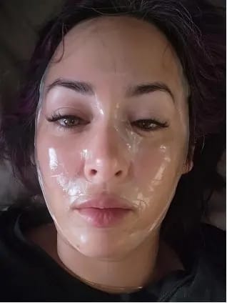 Customer photo review of LUMORA PDRN Renewal Infusion Mask