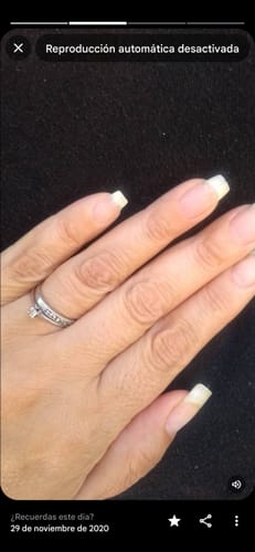 Customer photo review of Esmalte Endurecedor Uñas Débiles Thuya