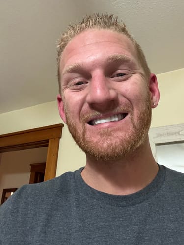 Customer smiling confidently, showing his bright white Pop On Veneers.