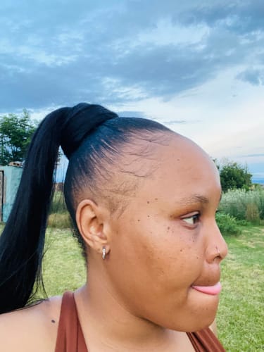 Customer photo review of Minoxidil High Strength (5%) SOLUTION, 3x60ml pack