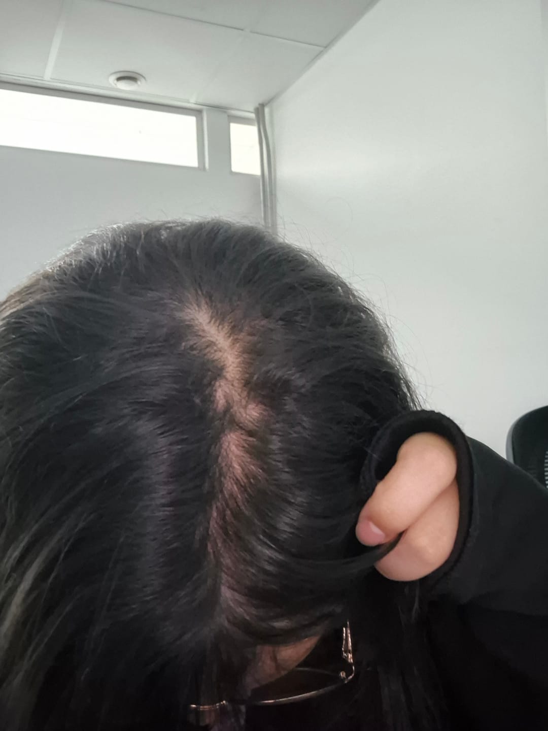 Customer photo review of Shampoo Anticaída Jaborandi 300ml