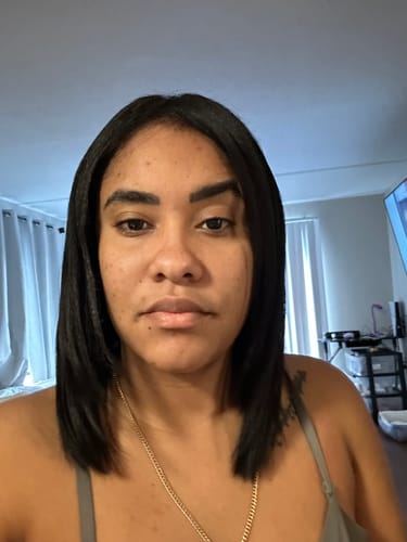 Customer photo review of Recovery Reconstructor 12-in-1