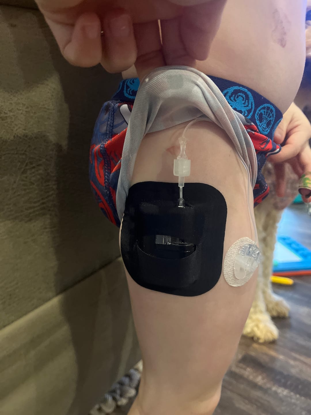 Customer photo review of Skin Grip - Tandem Mobi Pocket Patch