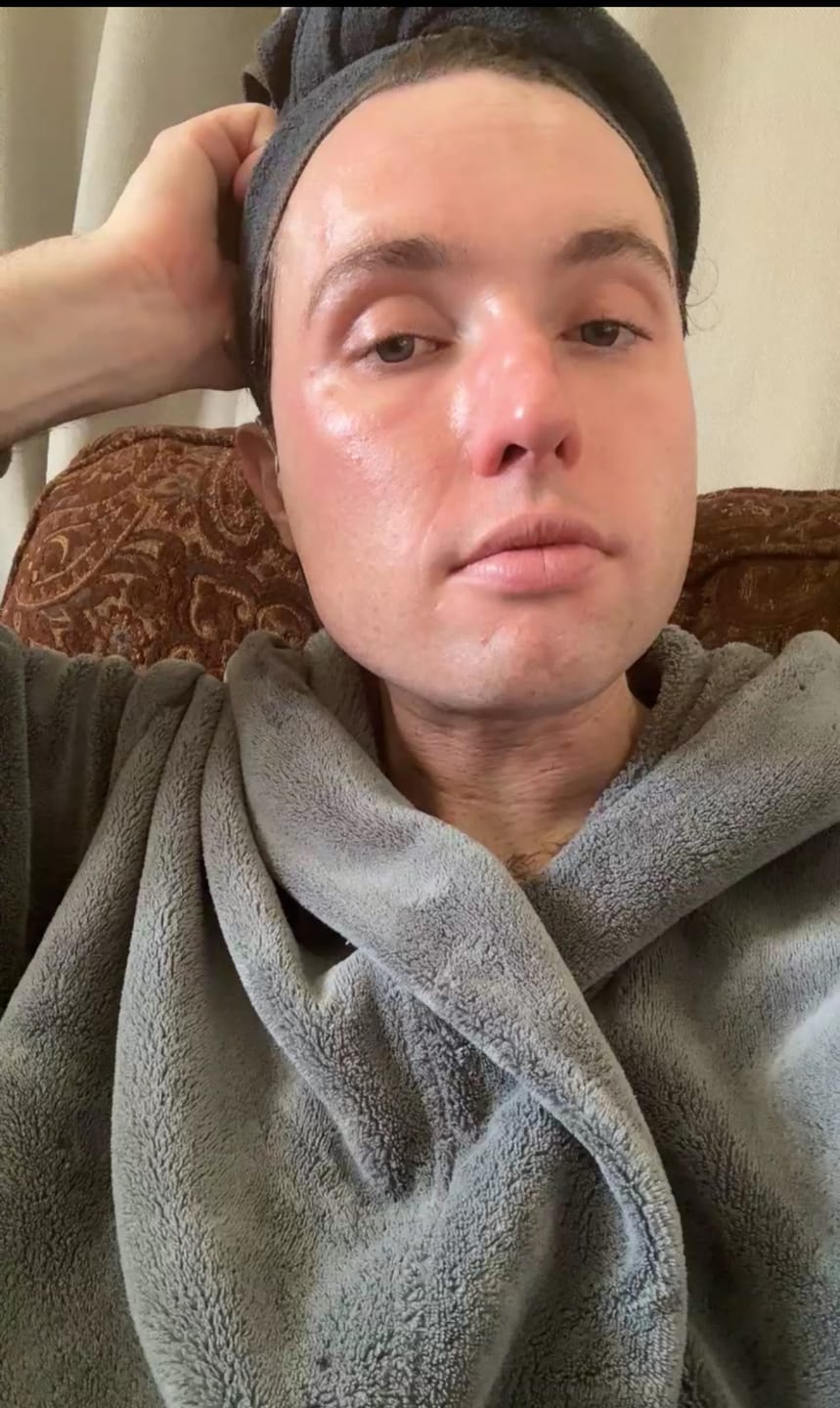 Customer photo review of Regenerative Oil