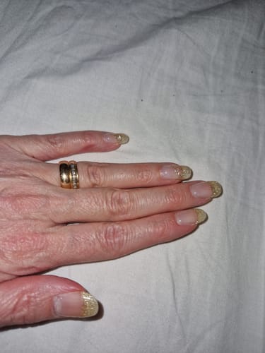 Customer photo review of Fraktförsäkring