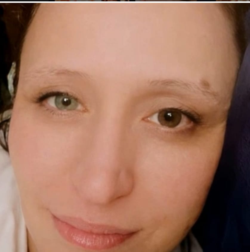Customer photo review of Clover Green Prescription Colored Contact Lenses