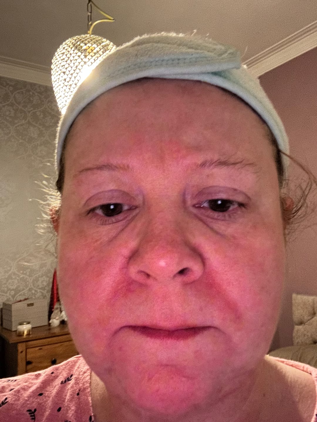 Customer photo review of Calm Skin-Relief Kit