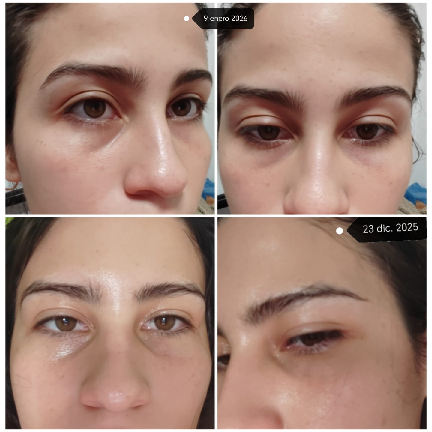 Customer photo review of Retinal Shot Tightening Booster
