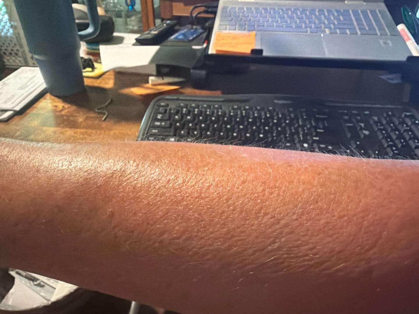 Customer photo review of Botanical Body Oil™