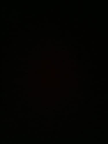 Customer's image of Aesthetic Labs Peptido IGF1-LR3, content is obscured by complete darkness