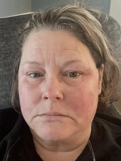 Customer photo review of The Age-Defying Serum
