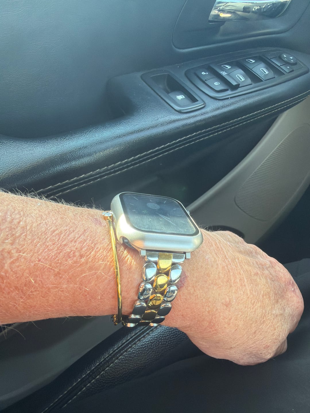Customer photo review of Prestige Duo Luxury Apple Watch Strap