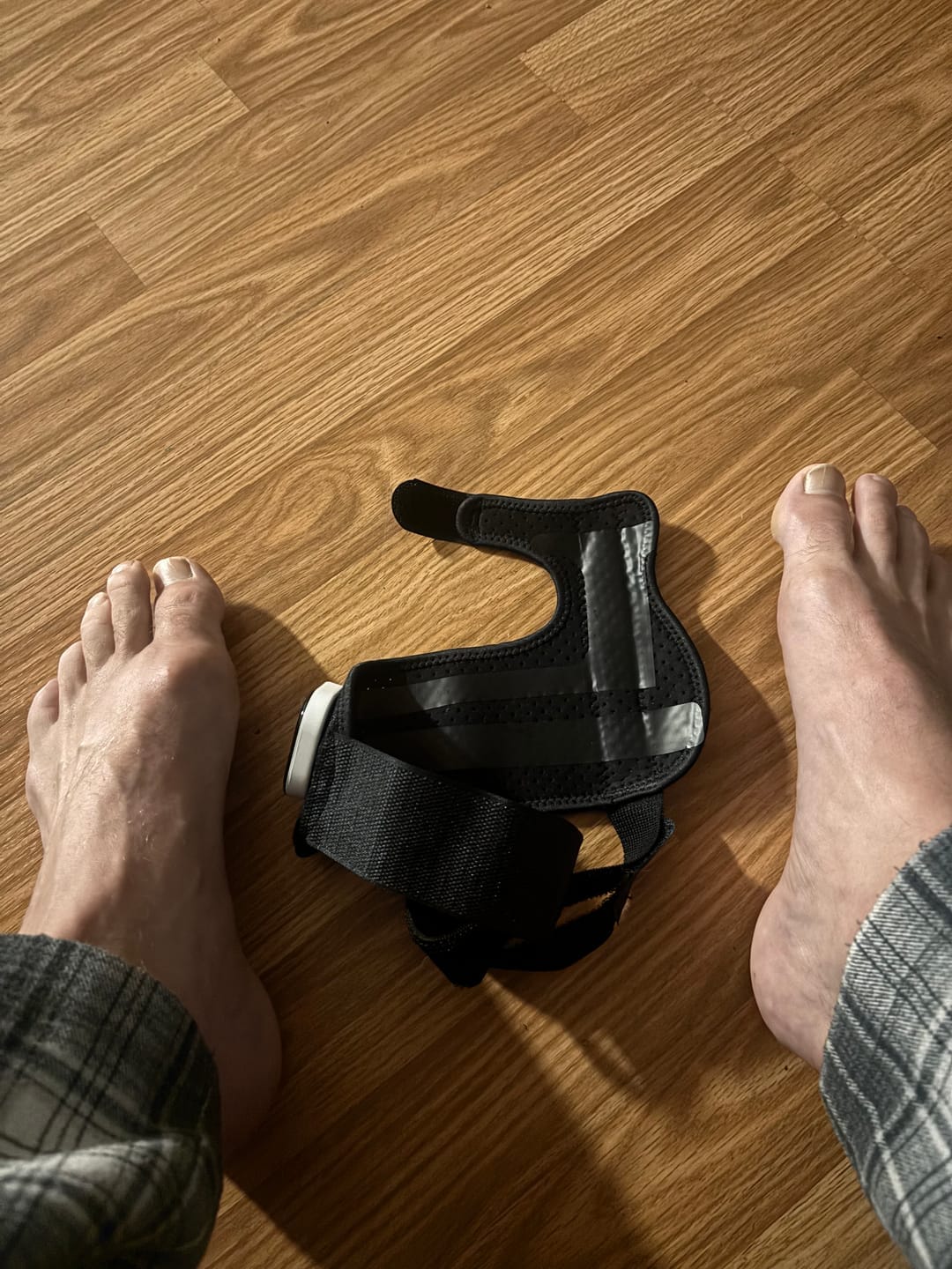 Customer photo review of ToeShape-EMS Bunion Corrector