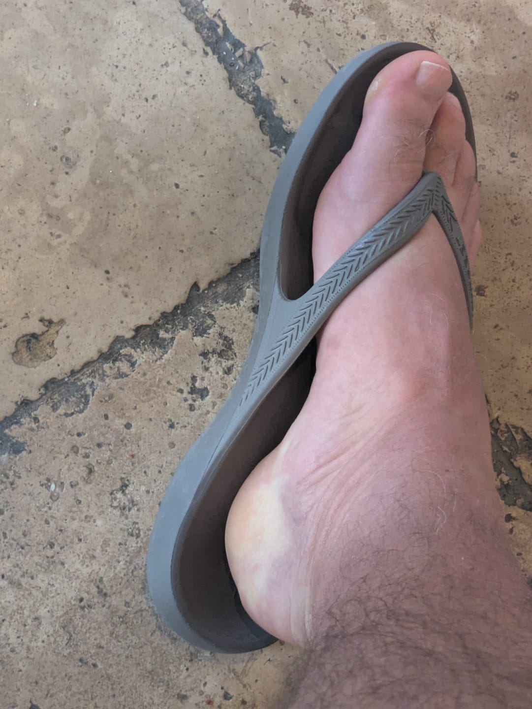 Customer photo review of Coastal Grey - Lightfeet Arch Support Flip Flops