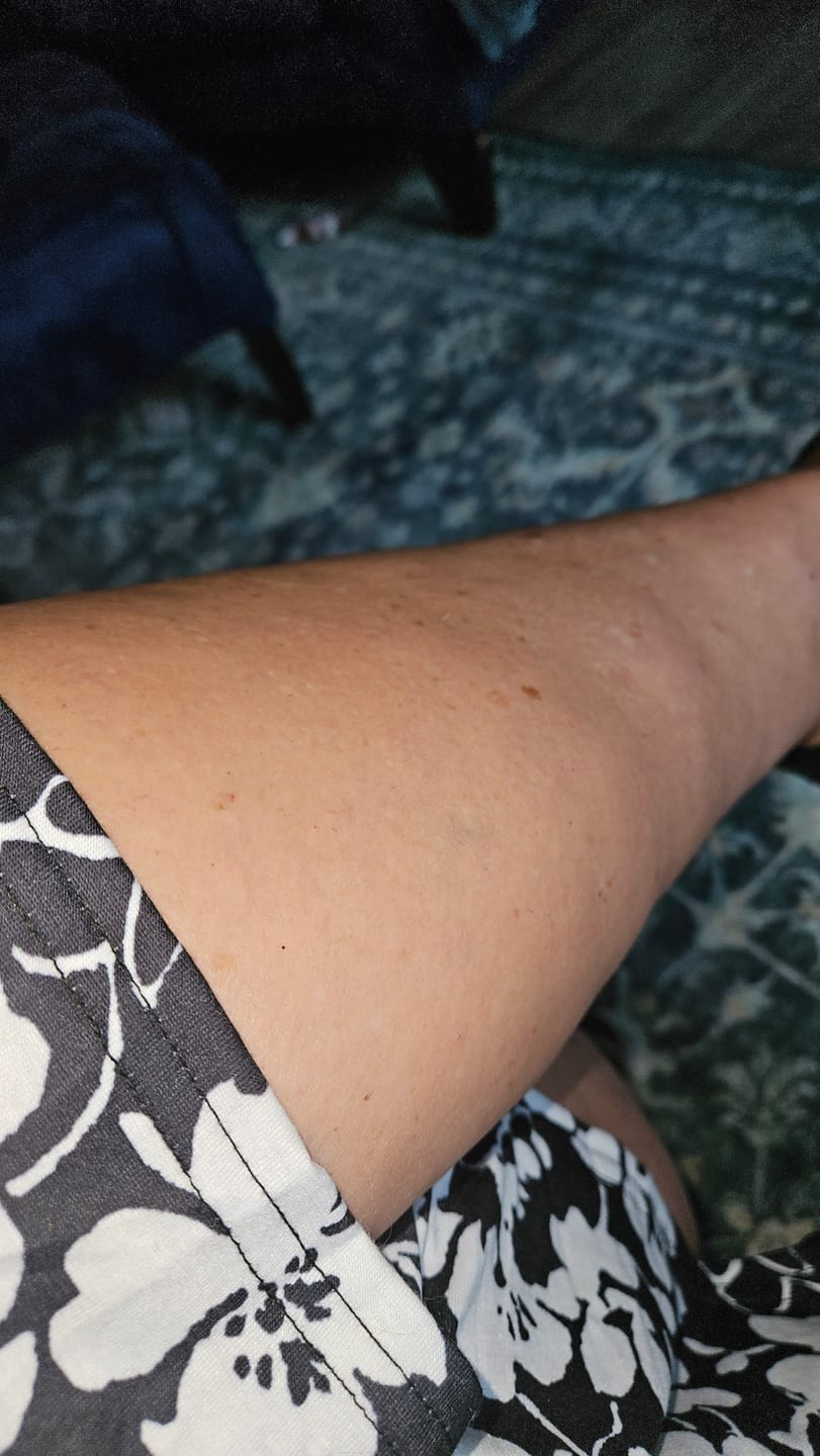 Customer photo review of Body Serum