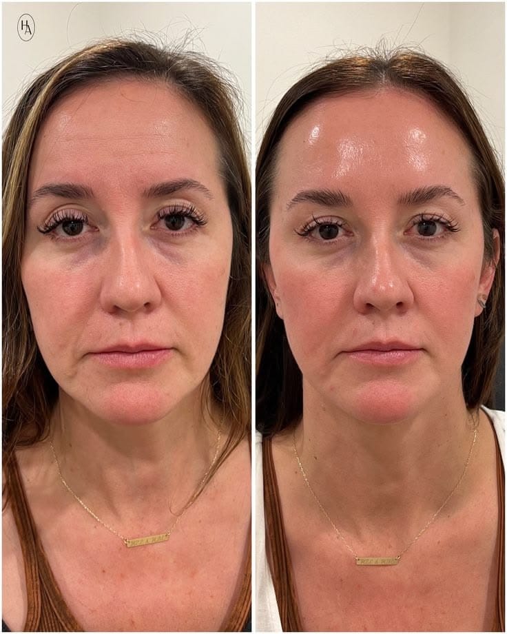 Customer photo review of Sistema Completo para piel de mujeres maduras