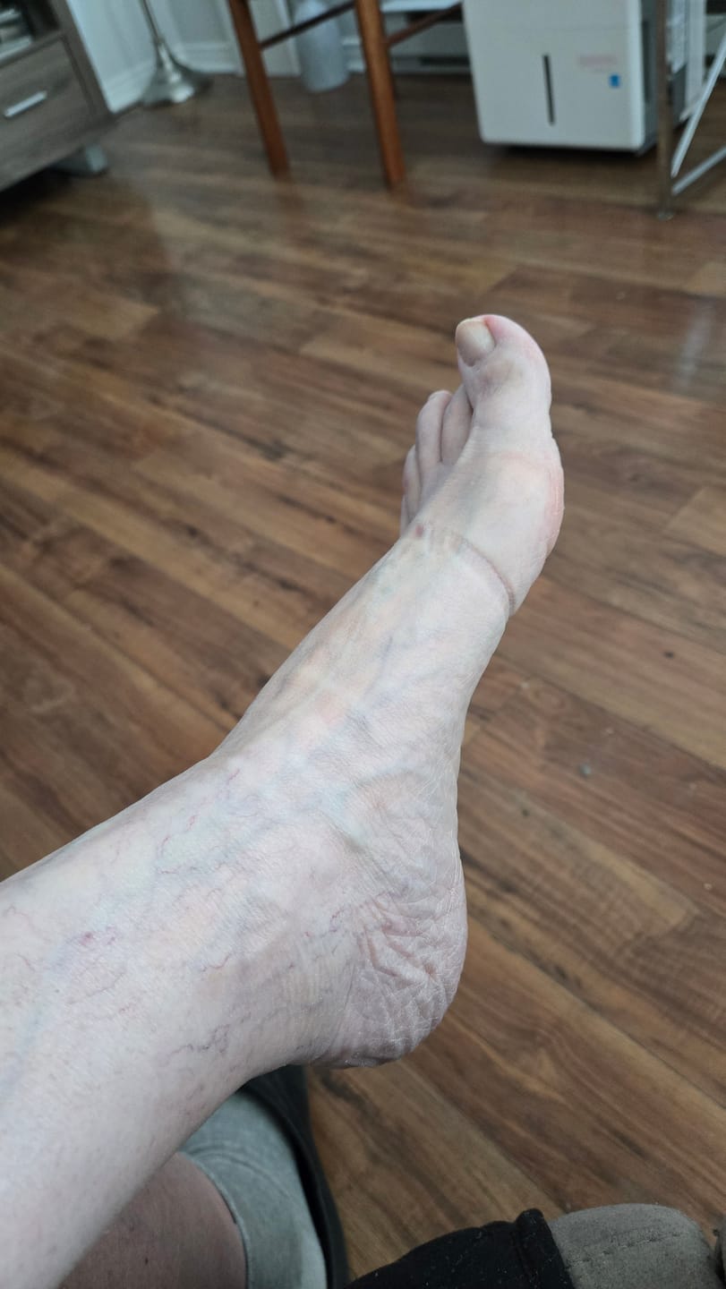Customer photo review of Premium Anti-Fatigue Bamboo Footsleeves