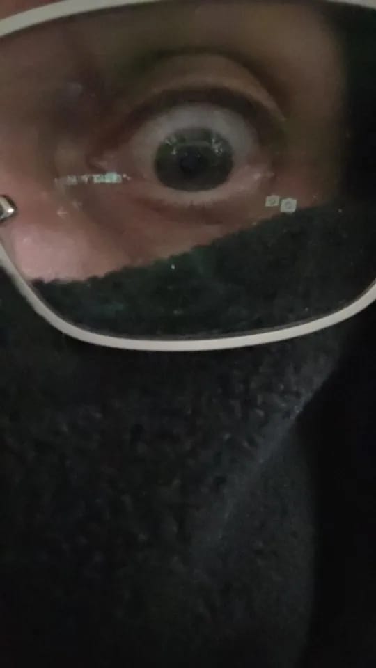 Customer photo review of SUPER MASK 3 EN 1 (35% OFF)