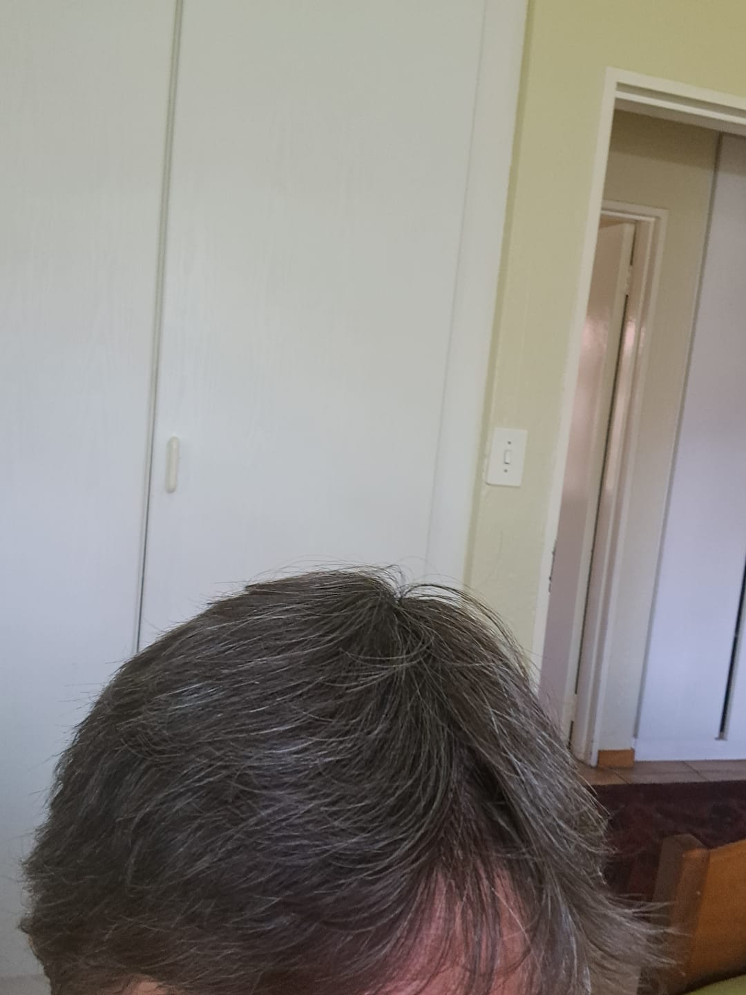Customer photo review of Detangler
