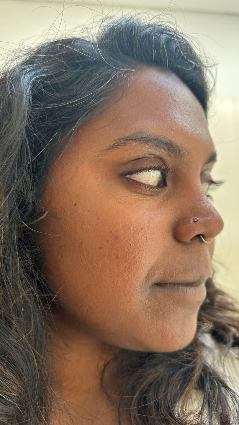 Customer photo review of BEAUBIT Daily Sunscreen SPF50 PA+++