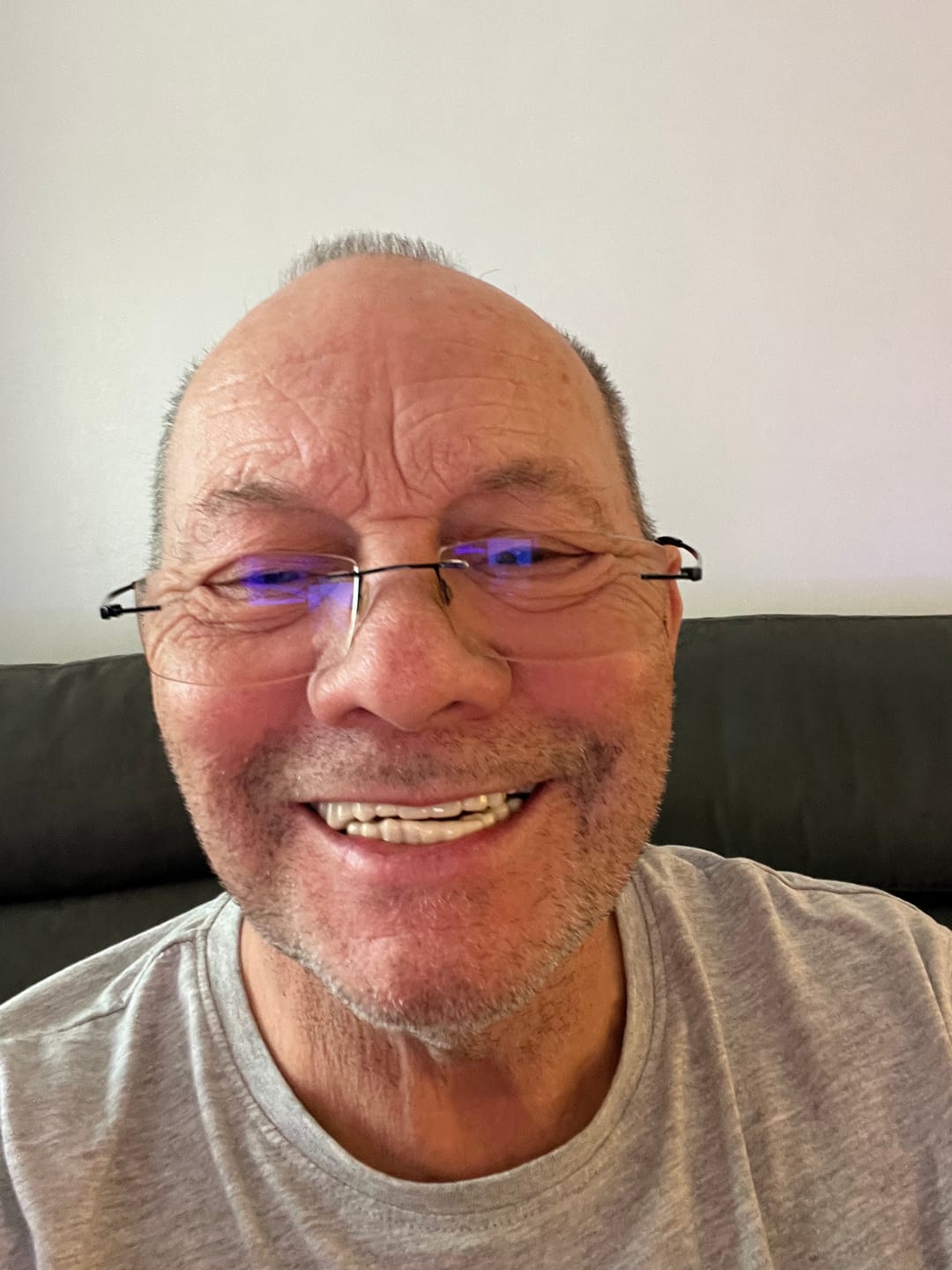 Customer photo review of Click-in Veneers 4.0