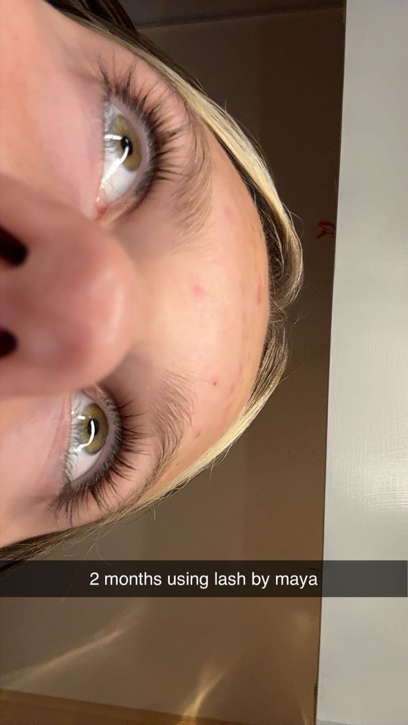 Customer photo review of LASH GROWTH SERUM