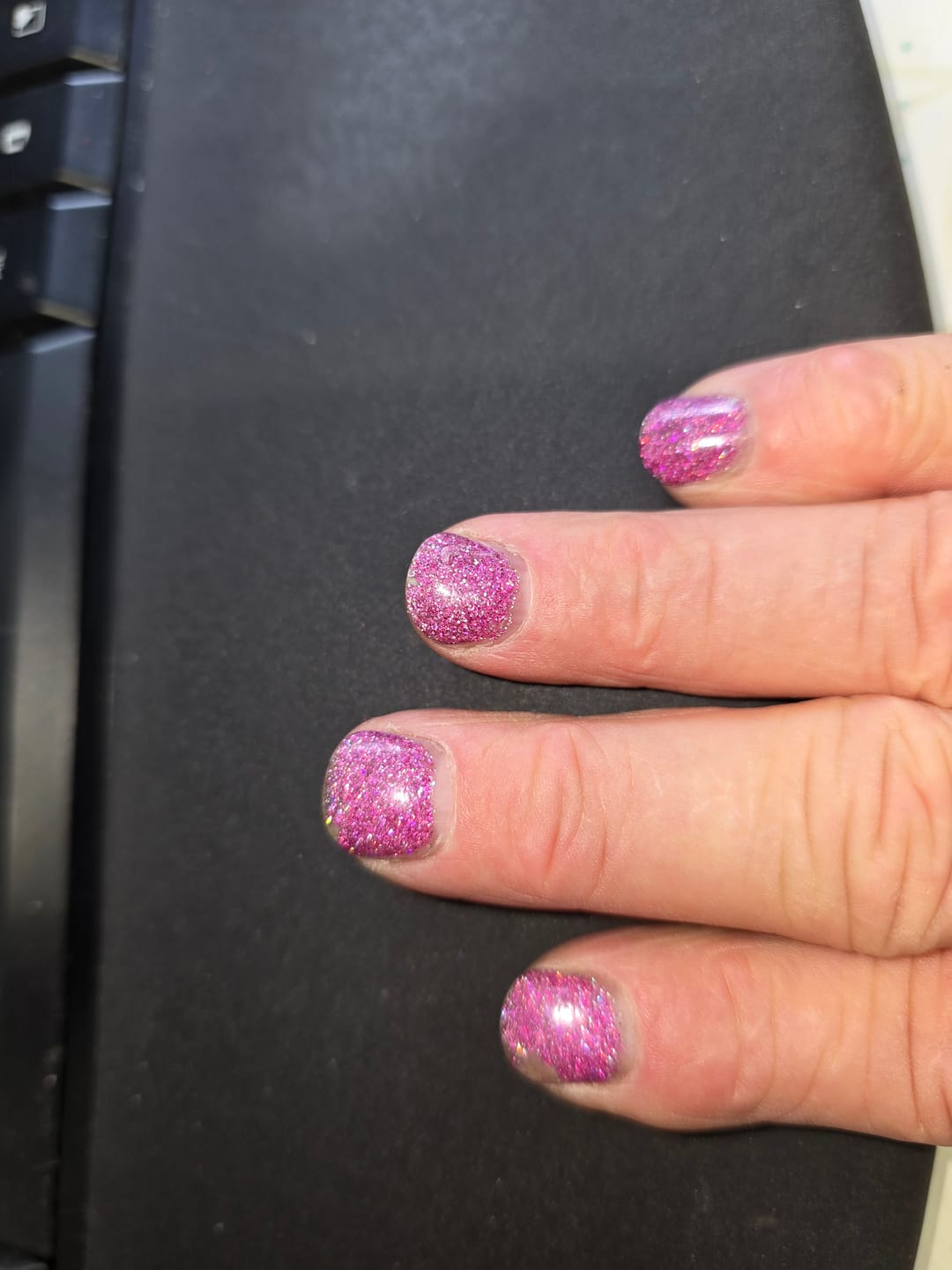 Customer photo review of Verwijder Wattenbollen (100 stuks)