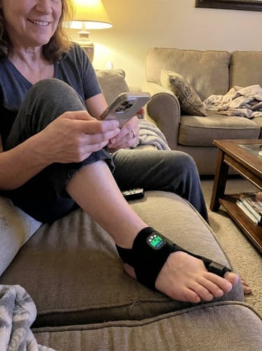 Customer photo review of ToeShape-EMS Bunion Corrector