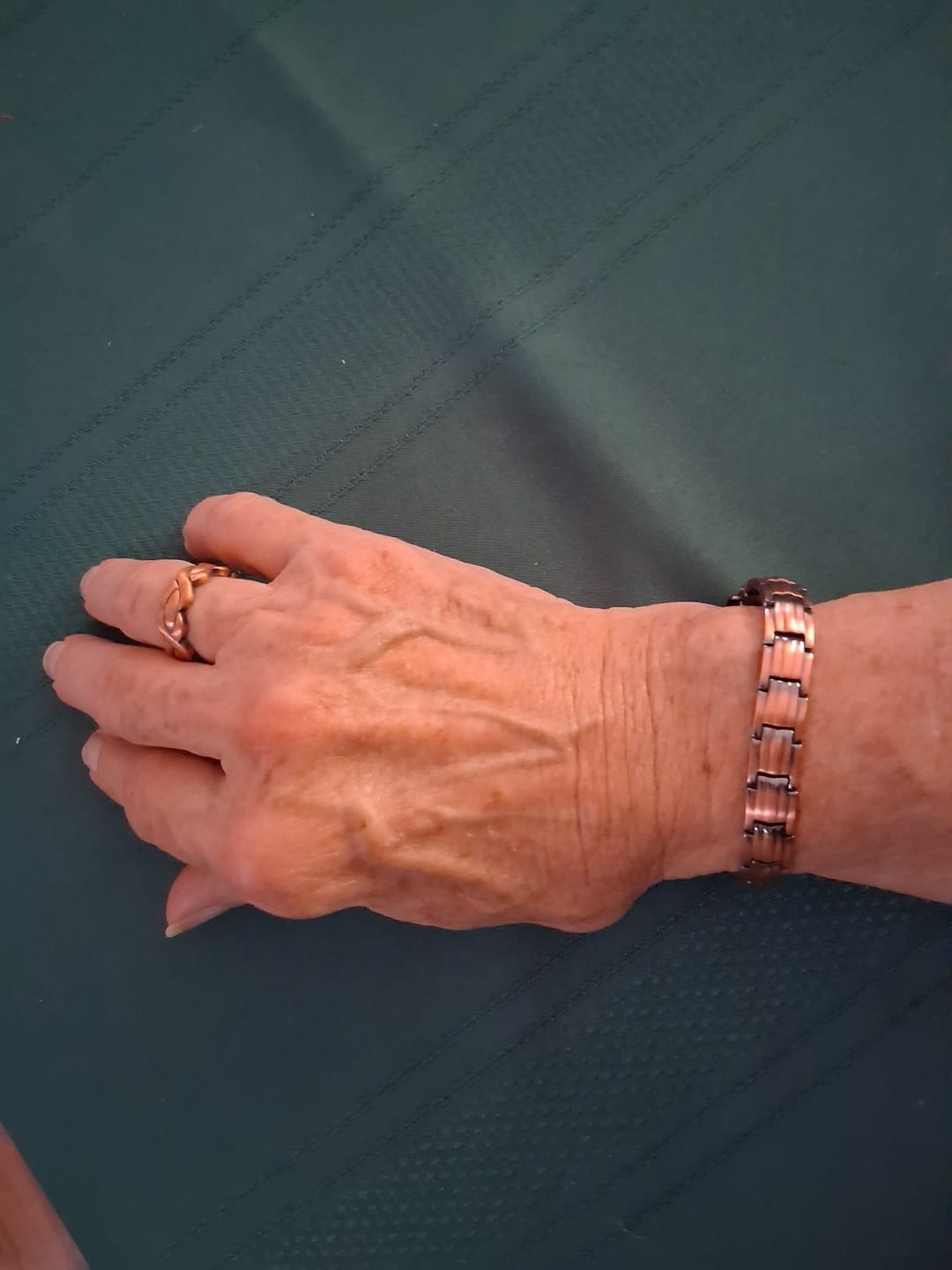 Customer photo review of Ladies Adjustable Copper Magnetic Ring