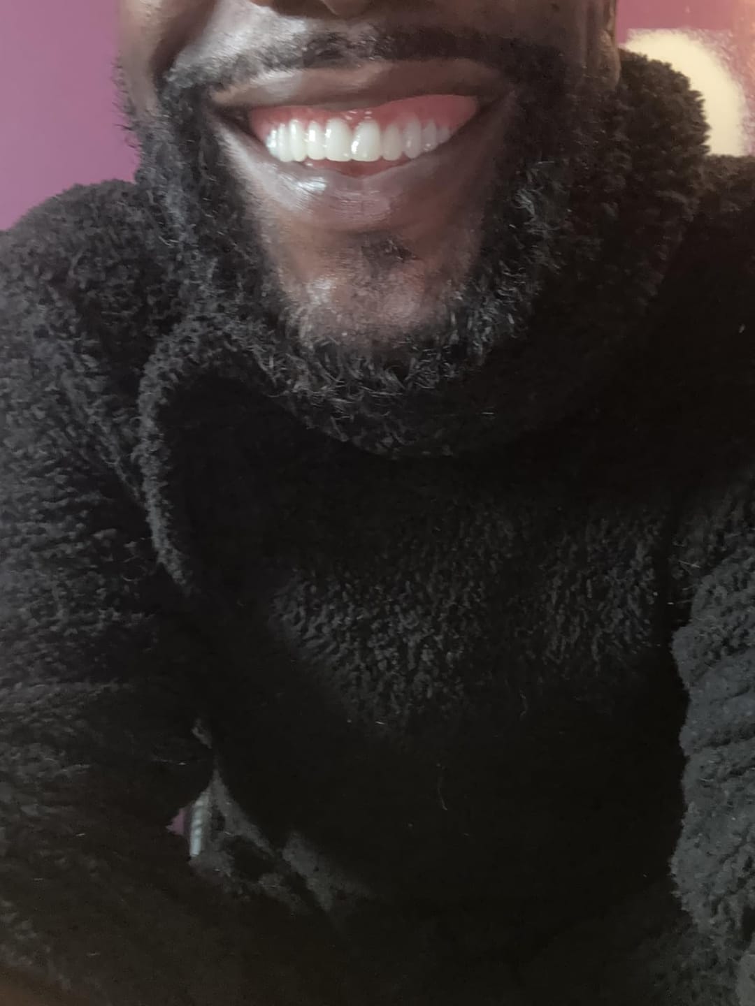 Customer photo review of Boil-And-Bite Medical-Grade Denture Set (Upper & Lower)