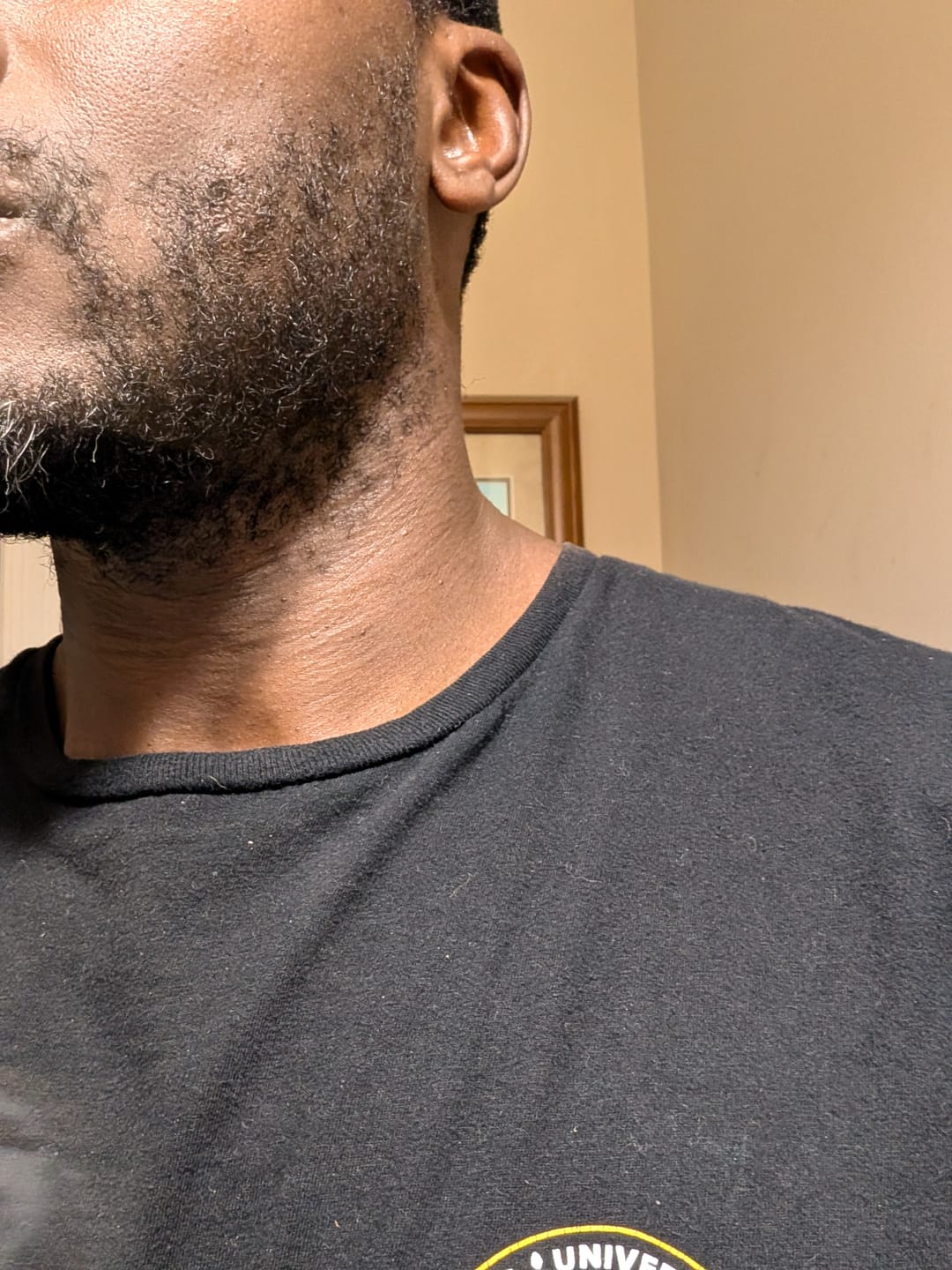 Customer photo review of Beard Care Kit
