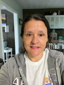 Customer photo review of Collagen Multi Balm Stick