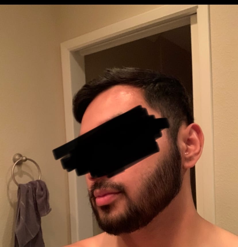 Customer photo review of Vanalie™ Hair Growth Roll-On Serum
