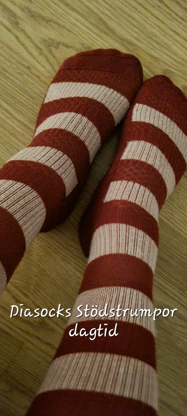 Customer photo review of Støttestrømper