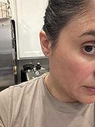 Customer photo review of Zero-Fit Korean Pimple Patch Duo