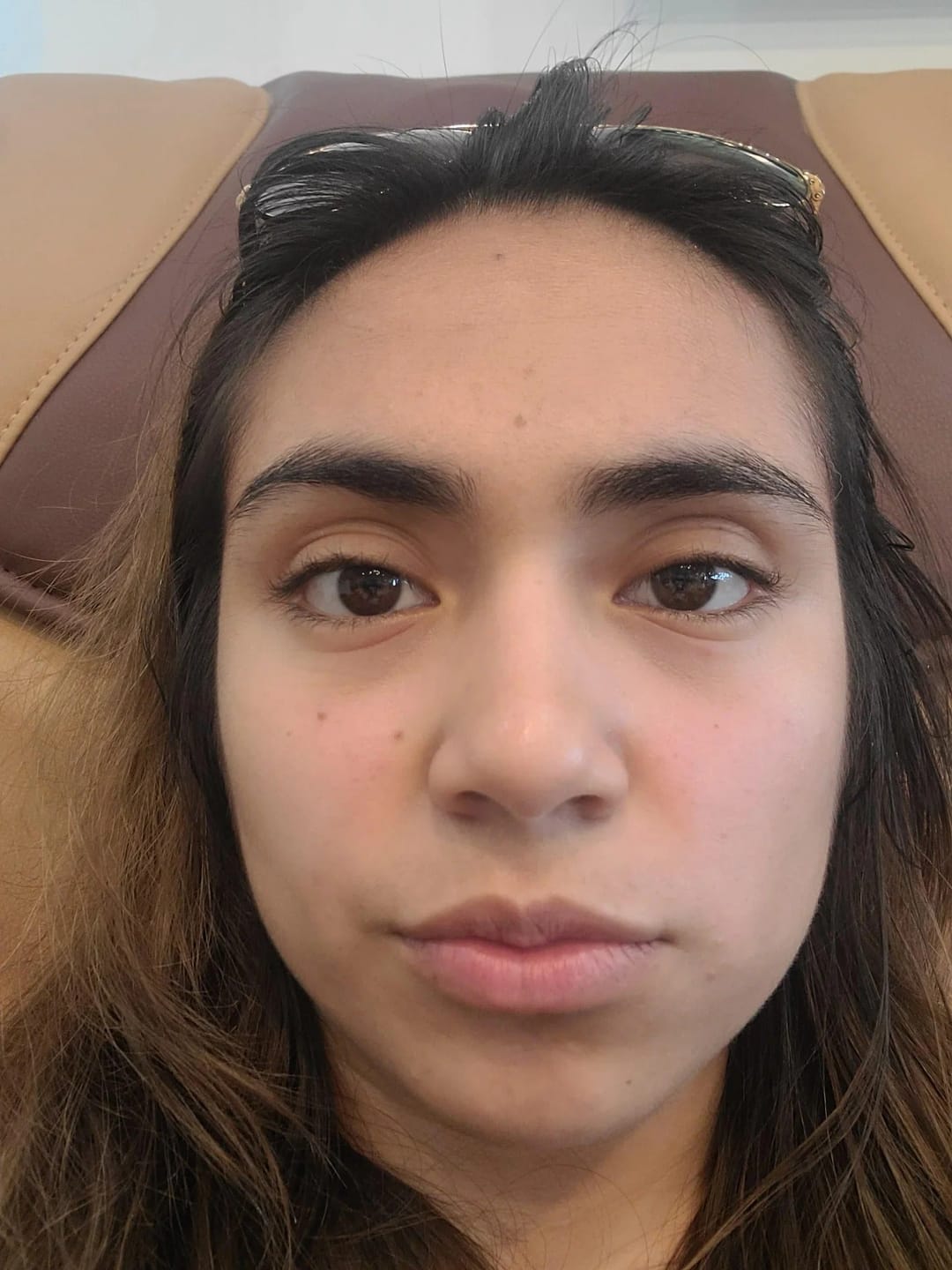 Customer photo review of Calcium Dark Spot Eye Cream