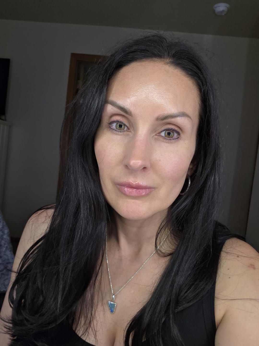 Customer photo review of Calcium Dark Spot Eye Cream