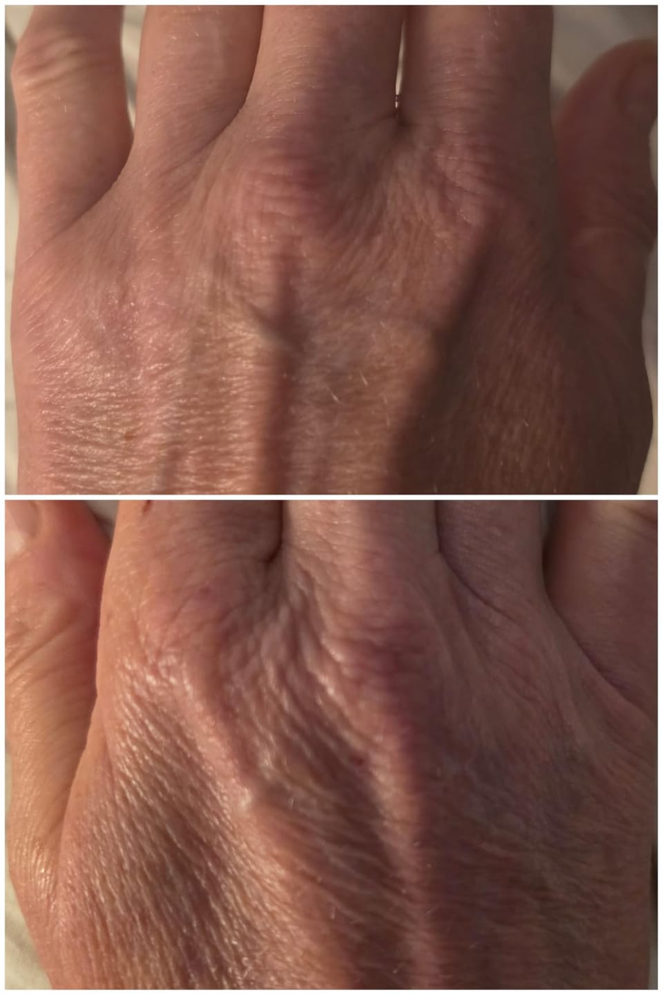 Customer photo review of Peel Shot Kojic Acid Turmeric Spray