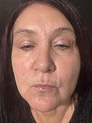 Customer photo review of Collagen Multi Balm Stick