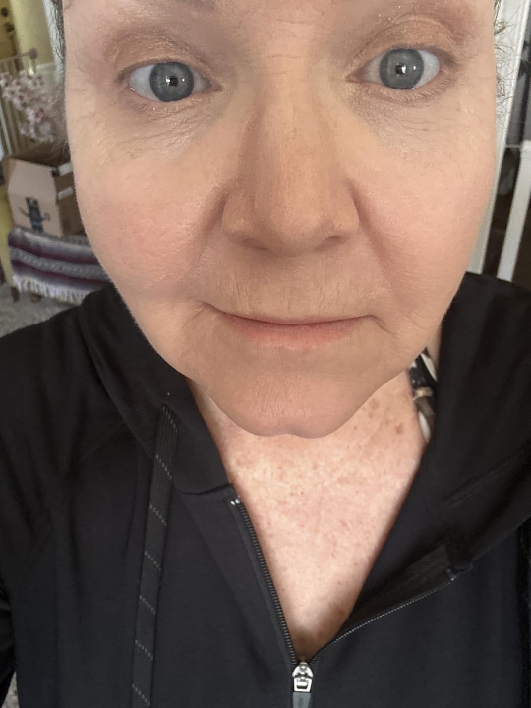 Customer photo review of Calcium Dark Spot Eye Cream