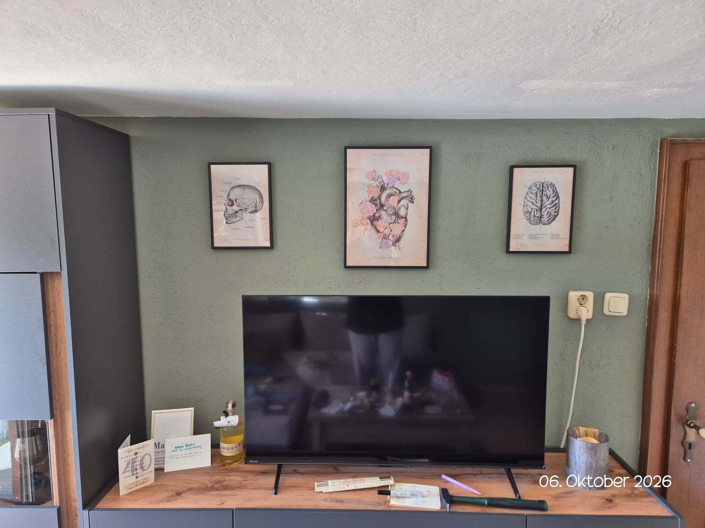 Customer photo review of Schädelknochen Anatomie