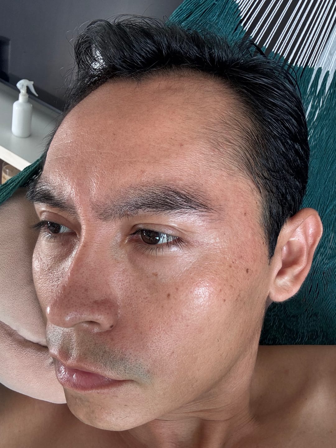 Customer photo review of Minoxidil 5 mg con 90 tabletas para 3 meses de tratamiento