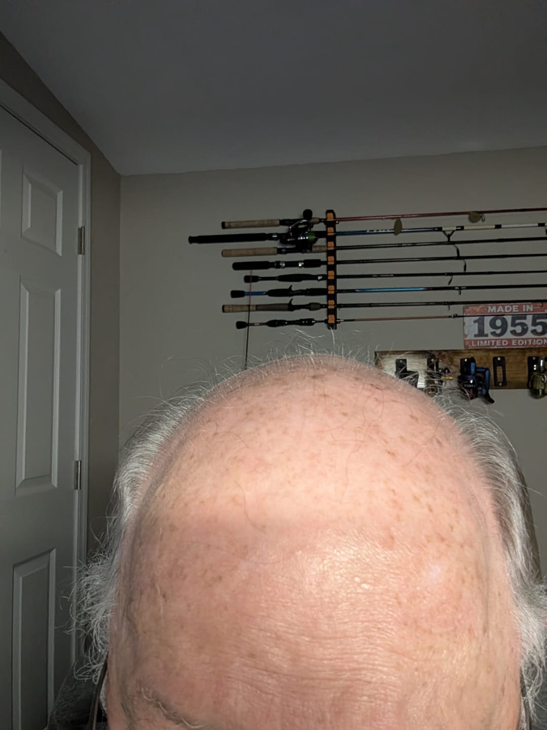 Customer photo review of Spartan™ Root Activator Shampoo 6 Bottles(sc)