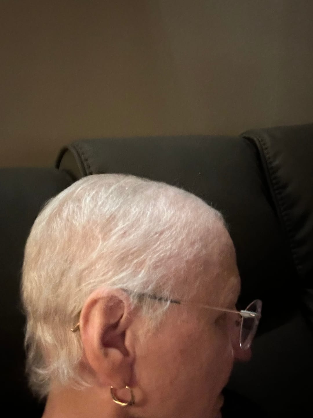 Customer photo review of Hair Growth Spray- Soothing Scalp Formula