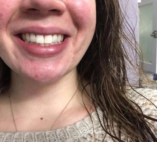 Customer photo review of DailyGlowSmile® Triple Action Teeth Whitening Powder