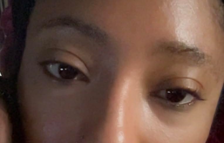 Customer photo review of Calcium Dark Spot Eye Cream