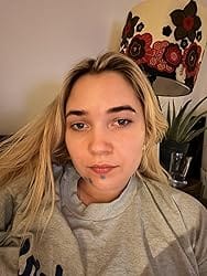 Customer photo review of Collagen Multi Balm Stick
