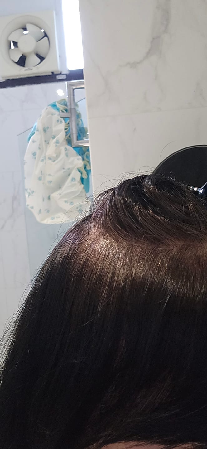 Customer photo review of SMiB Anti-Aging Series - Colour Change Shampoo for Grey Hair