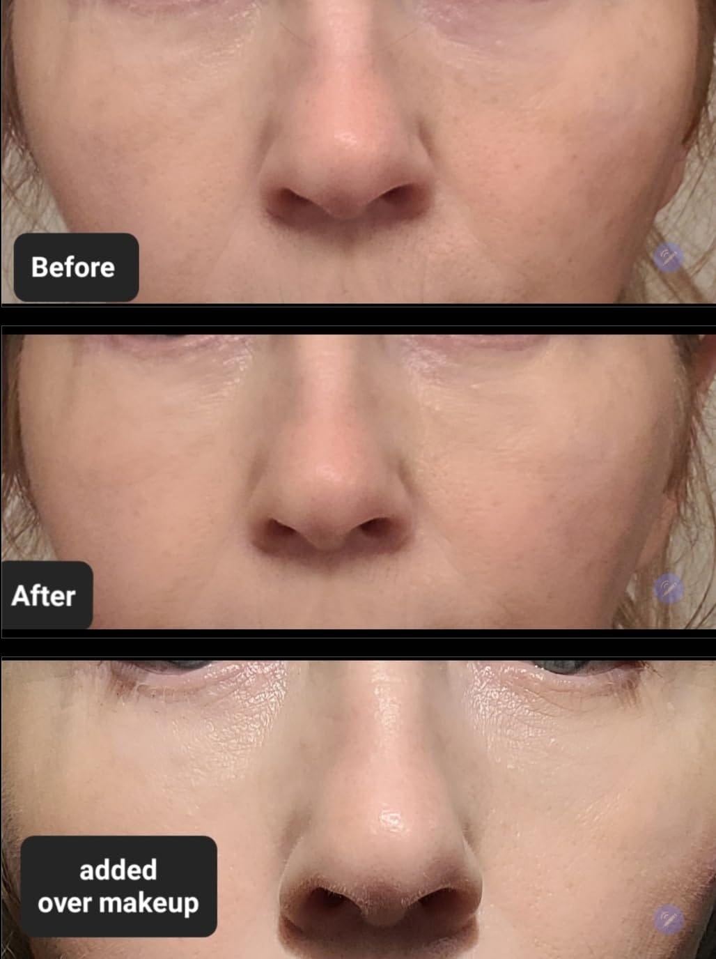 Customer photo review of Calcium Dark Spot Eye Cream