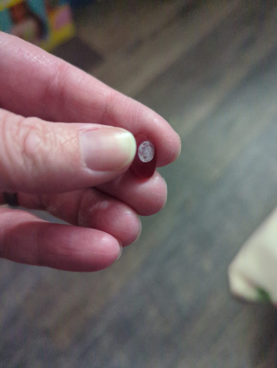 Customer photo review of Strawberry Studs Hypoallergenic Earrings for Sensitive Ears with Plastic Posts